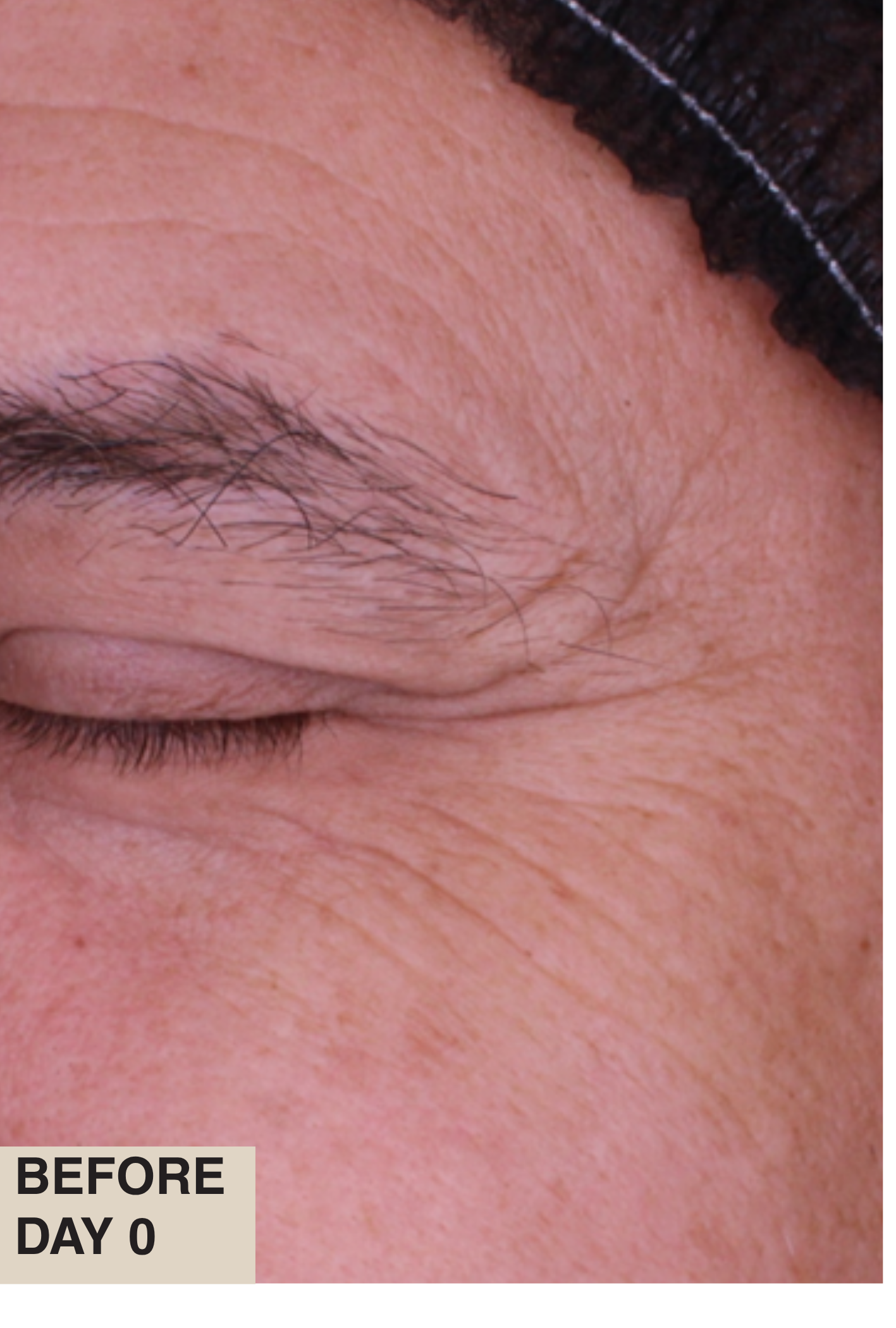 Before treatment skin close-up