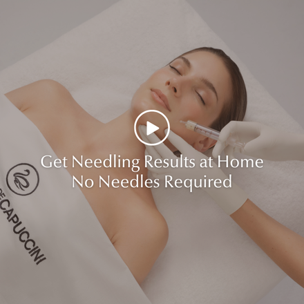 Get Needling Results at Home — No Needles Required