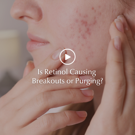 Young woman experiencing retinol purging and a weakened skin barrier