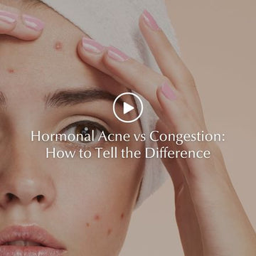 Hormonal Acne vs Congestion: How to Tell the Difference