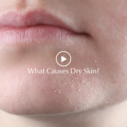 What Causes Dry Skin? - Germaine de Capuccini AU