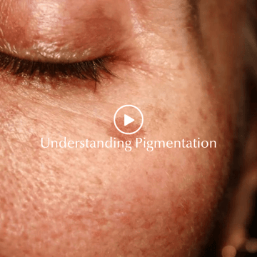 Understanding Pigmentation - Germaine De Capuccini AU