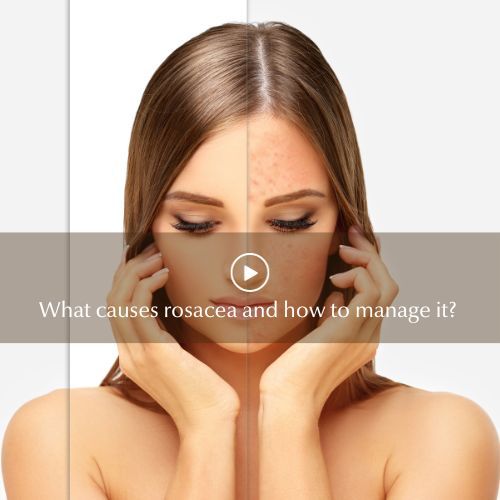 What Causes Rosacea and How to Manage This Skin Condition? - Germaine De Capuccini AU
