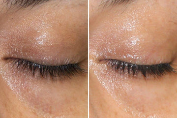 What is the best eye cream for dark circles? - Germaine De Capuccini AU