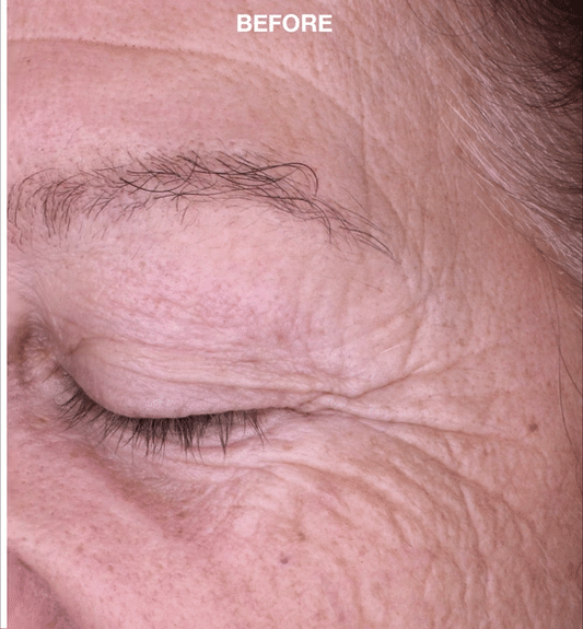 10463_E-LAB-BEFORE-AFTER-FACIAL_1