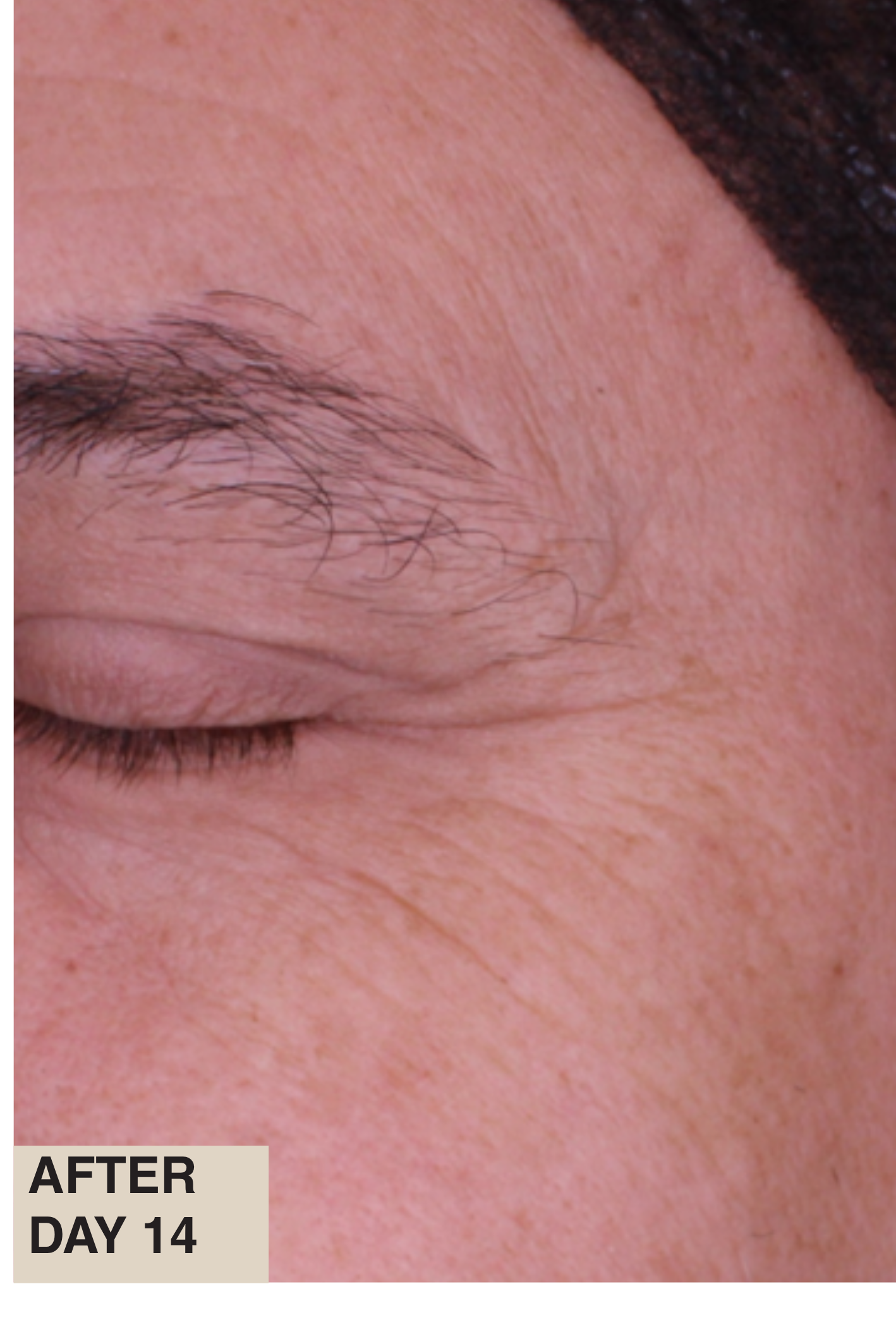 After treatment skin close-up